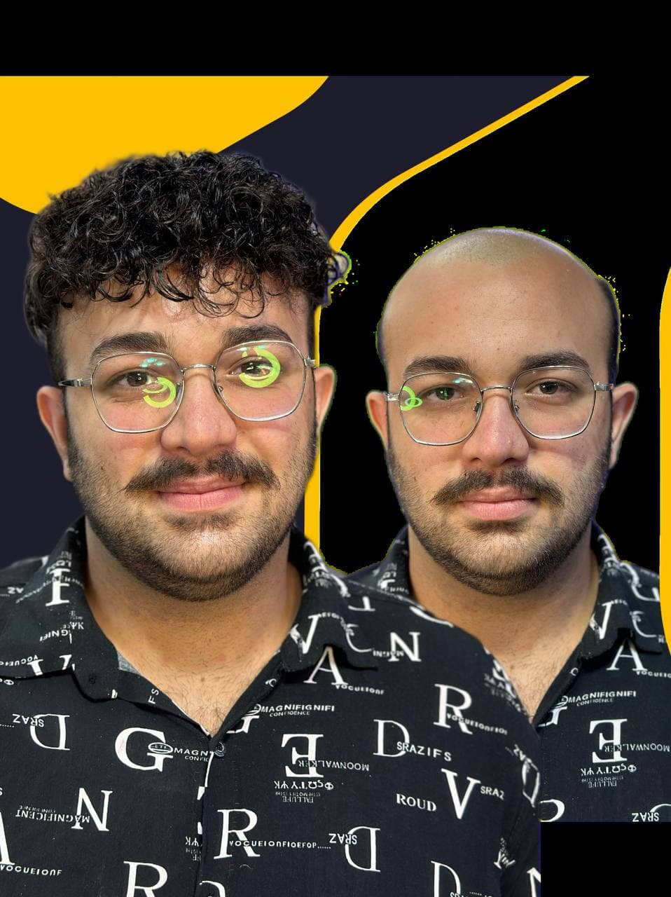 مرکز تخصصی پروتز مو ایران مو در اصفهان