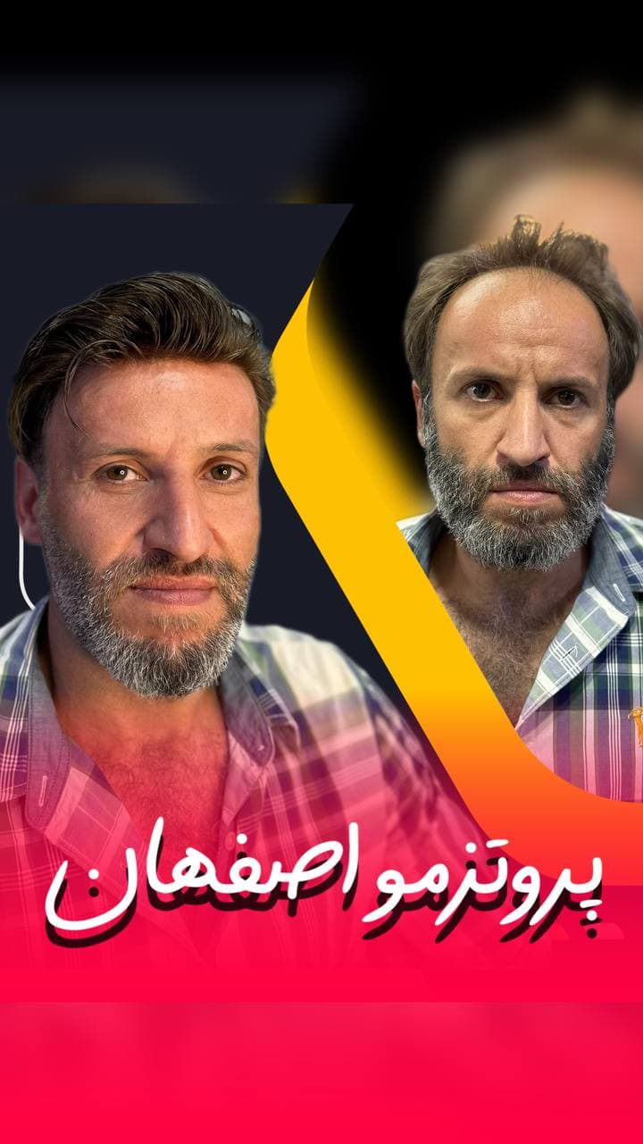 مرکز تخصصی پروتز مو ایران مو در اصفهان