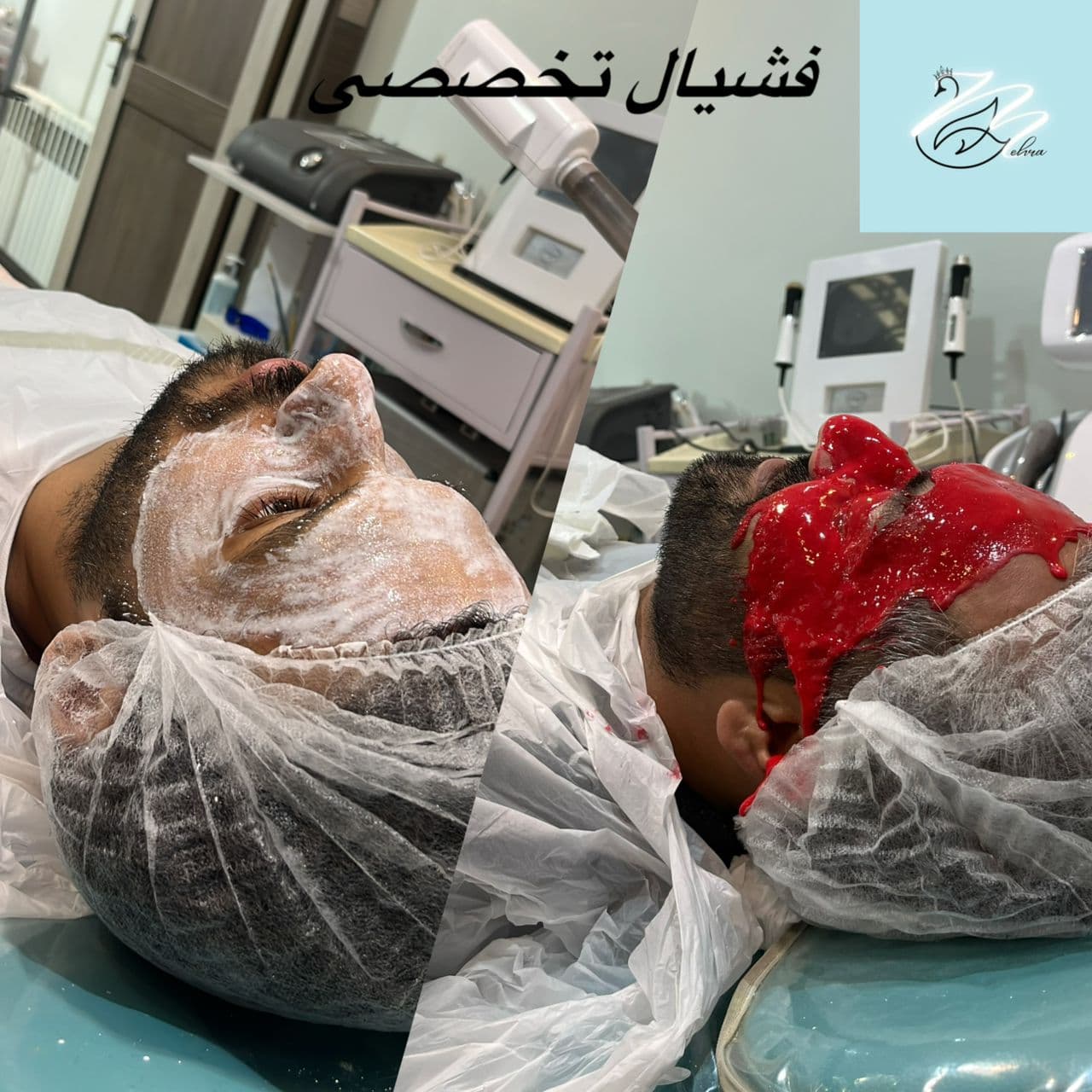 مرکز زیبایی پوست و مو مهرا در تجریش تهران