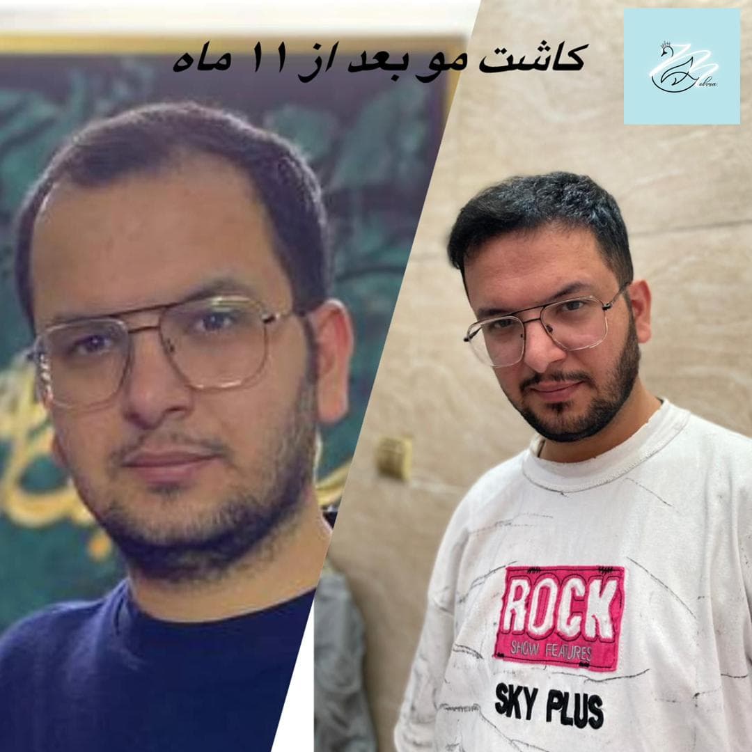 مرکز زیبایی پوست و مو مهرا در تجریش تهران