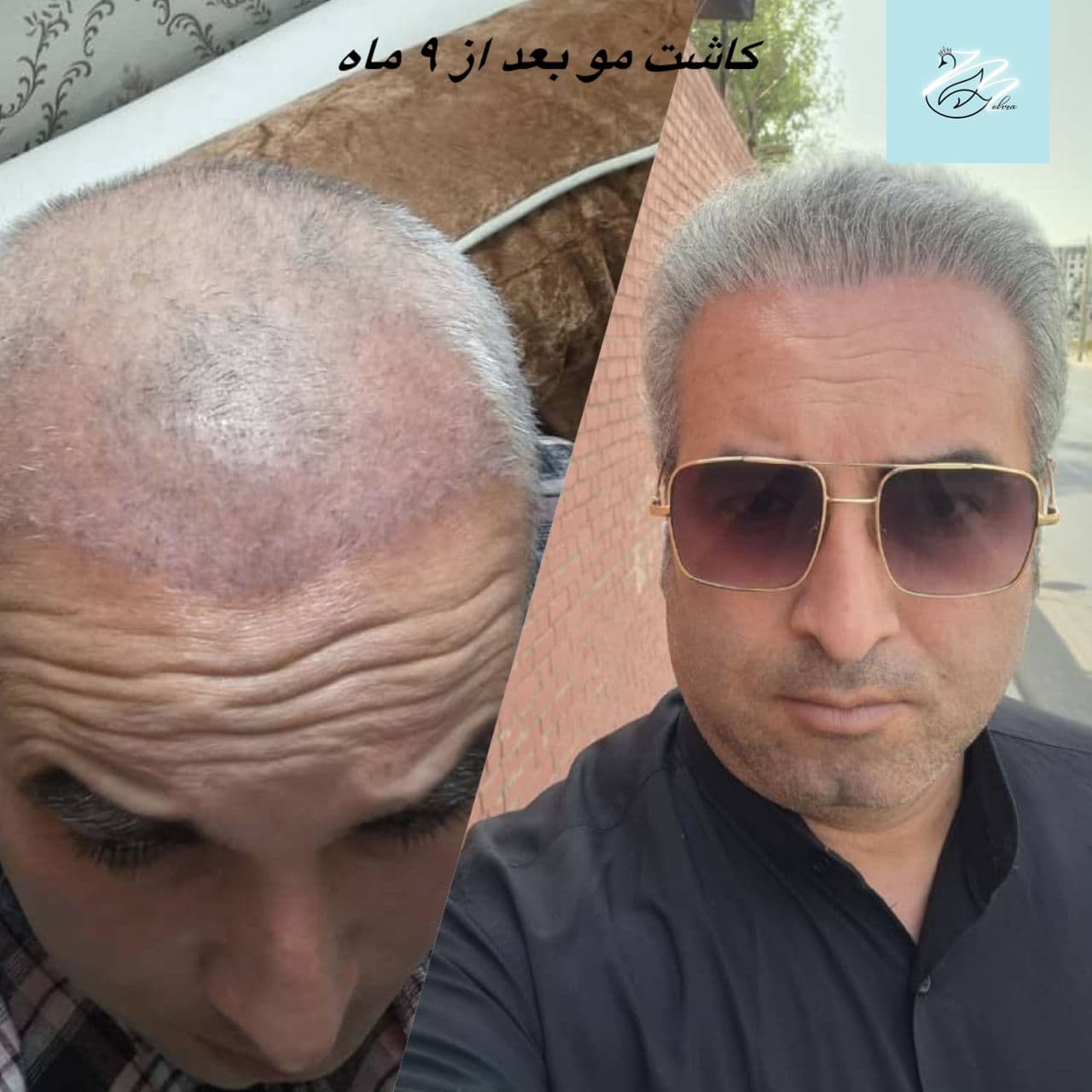 مرکز زیبایی پوست و مو مهرا در تجریش تهران