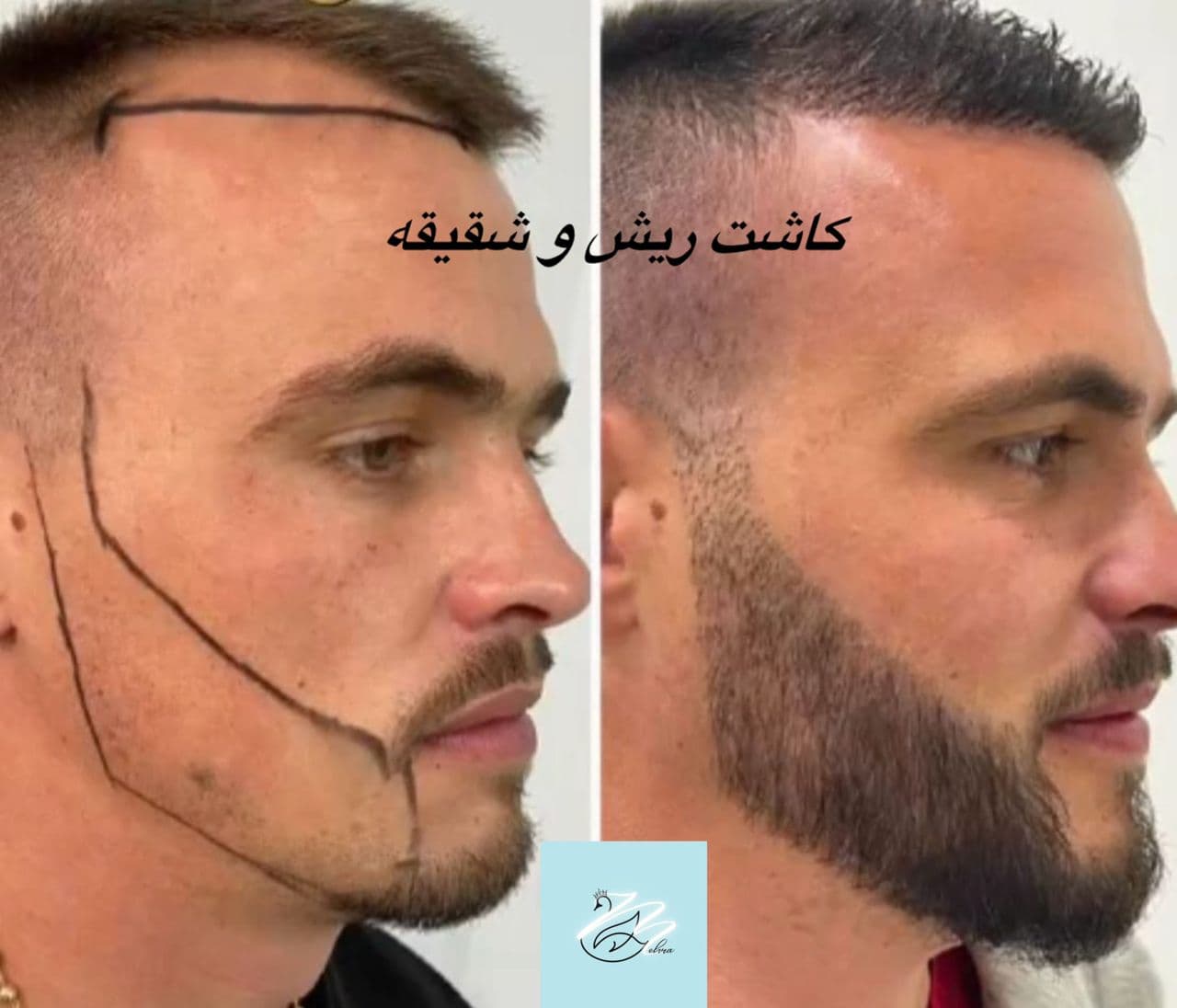 مرکز زیبایی پوست و مو مهرا در تجریش تهران