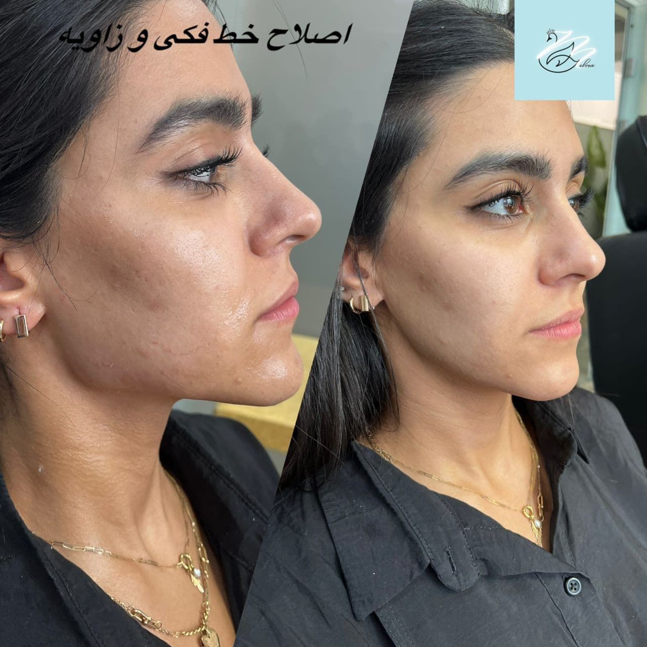 مرکز زیبایی پوست و مو مهرا در تجریش تهران