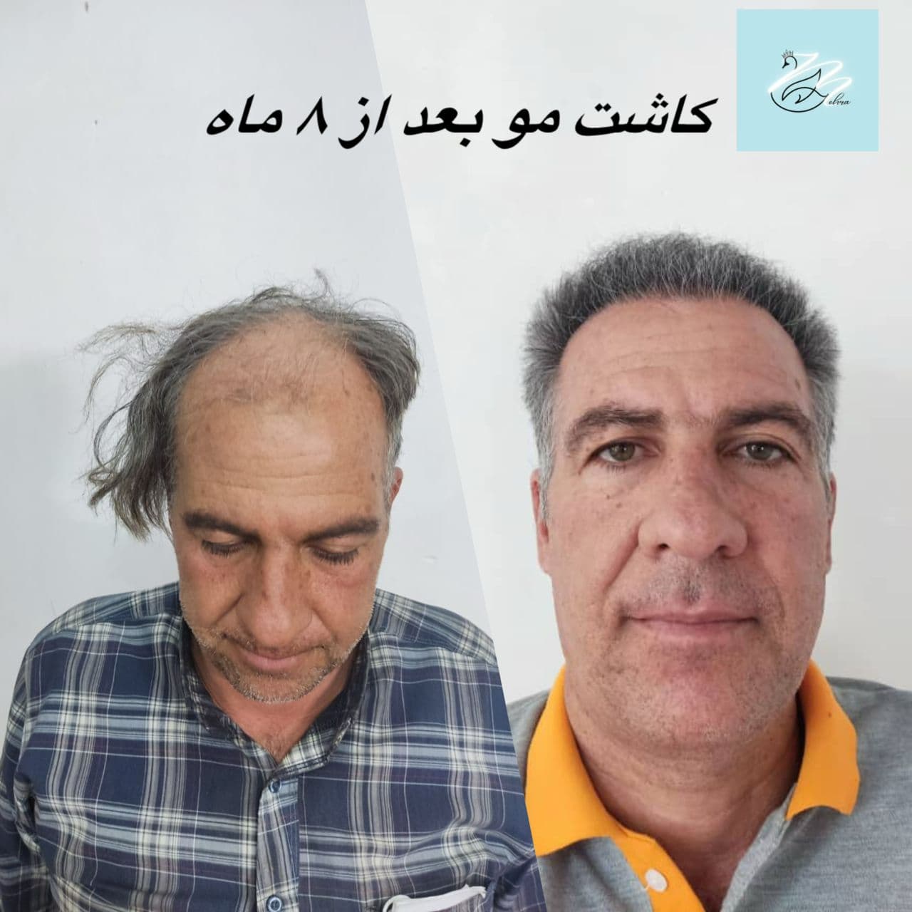 مرکز زیبایی پوست و مو مهرا در تجریش تهران