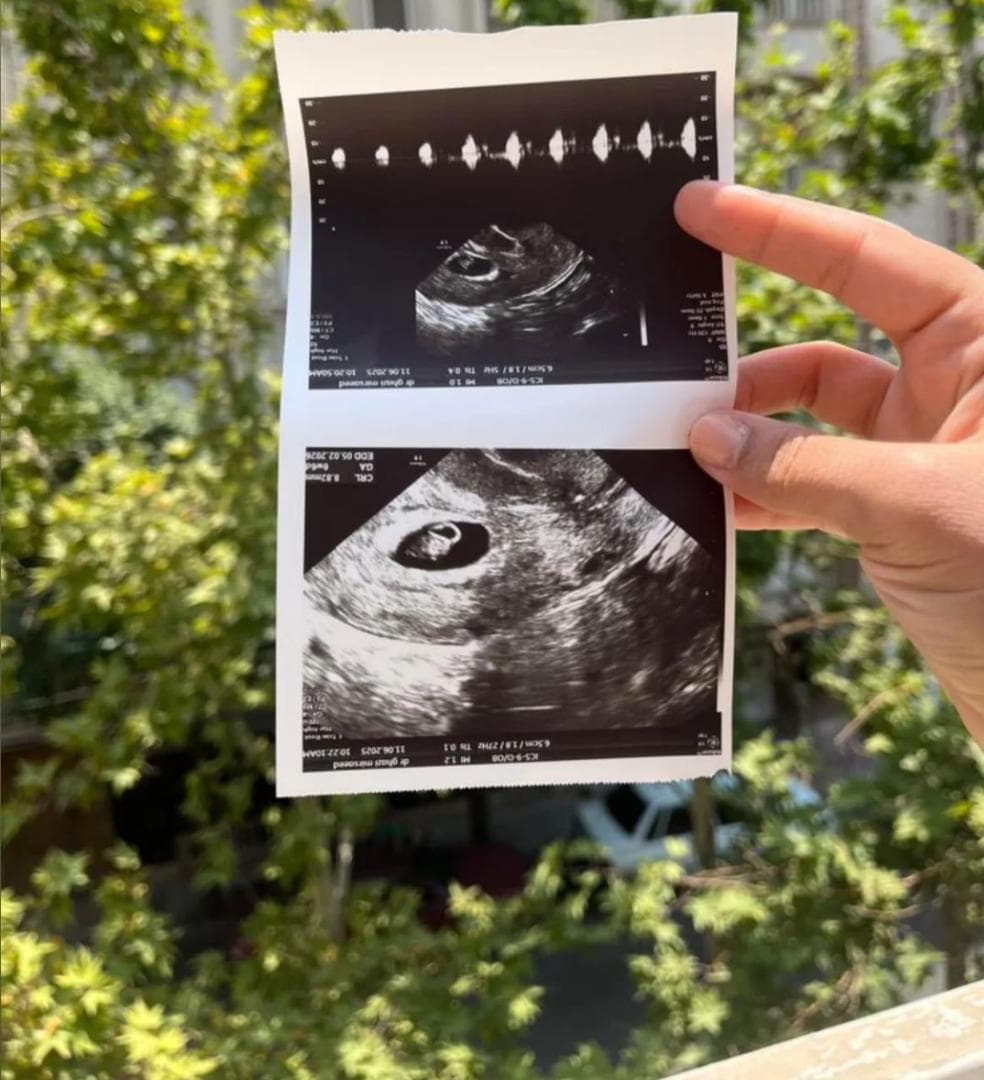 مرکز فوق تخصصی درمان نازایی و رحم اجاره ای نور در تهران