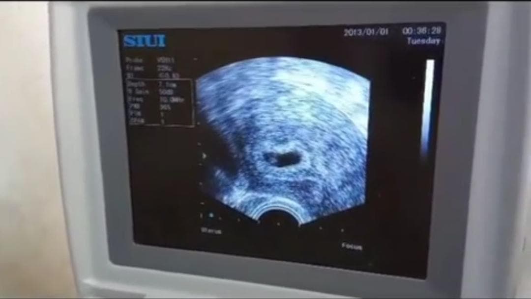 مرکز فوق تخصصی درمان نازایی و رحم اجاره ای نور در تهران