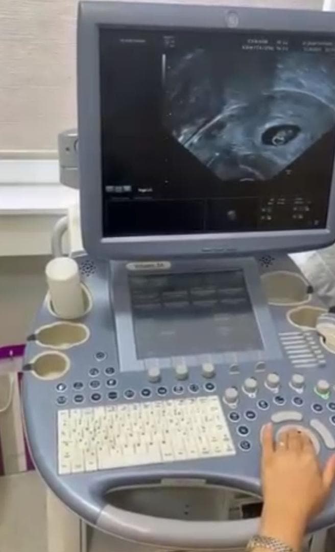 مرکز فوق تخصصی تخمک اهدایی و آی وی اف نور در تهران