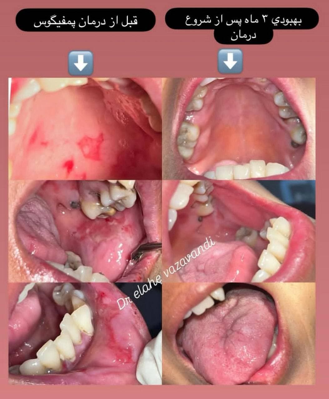 مطب تخصصی دندانپزشکی بیماران خاص دکتر الهه وزاوندی سیرجان
