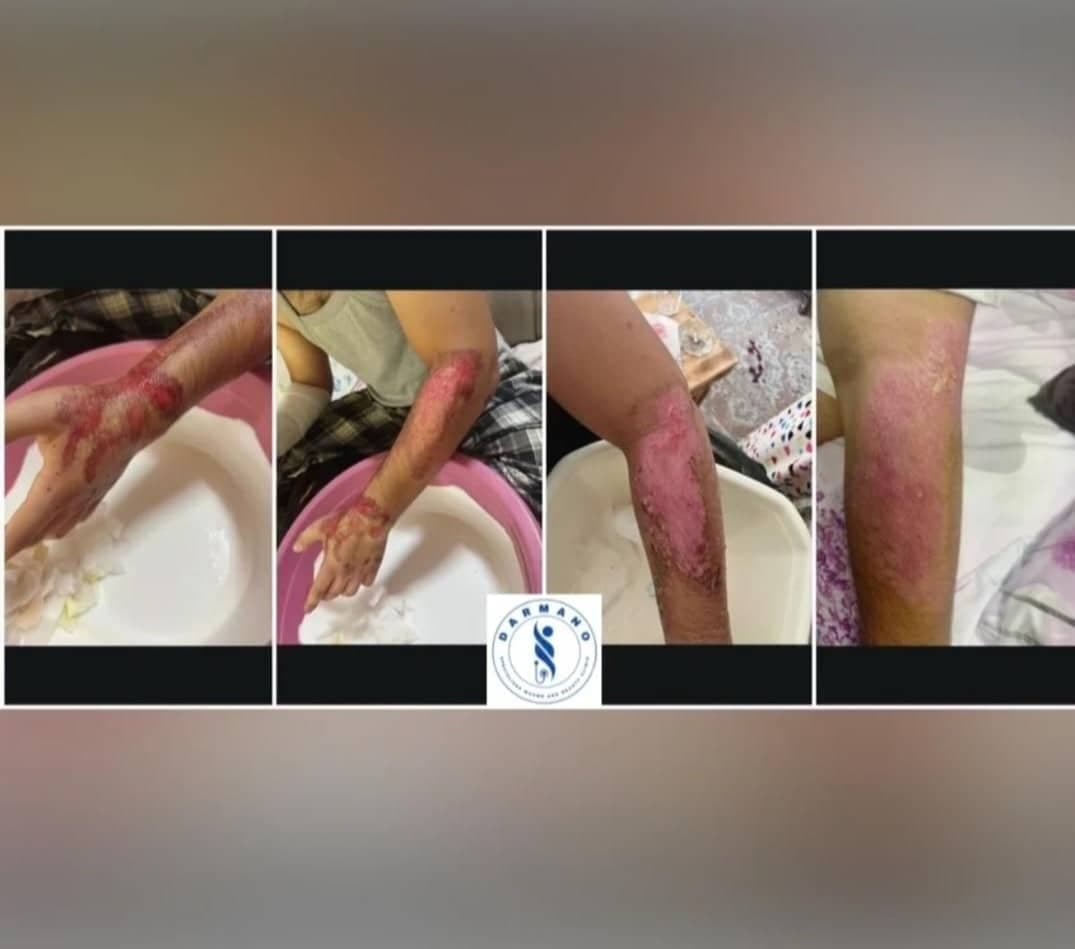 کلینیک تخصصی درمان زخم درمانو در اصفهان