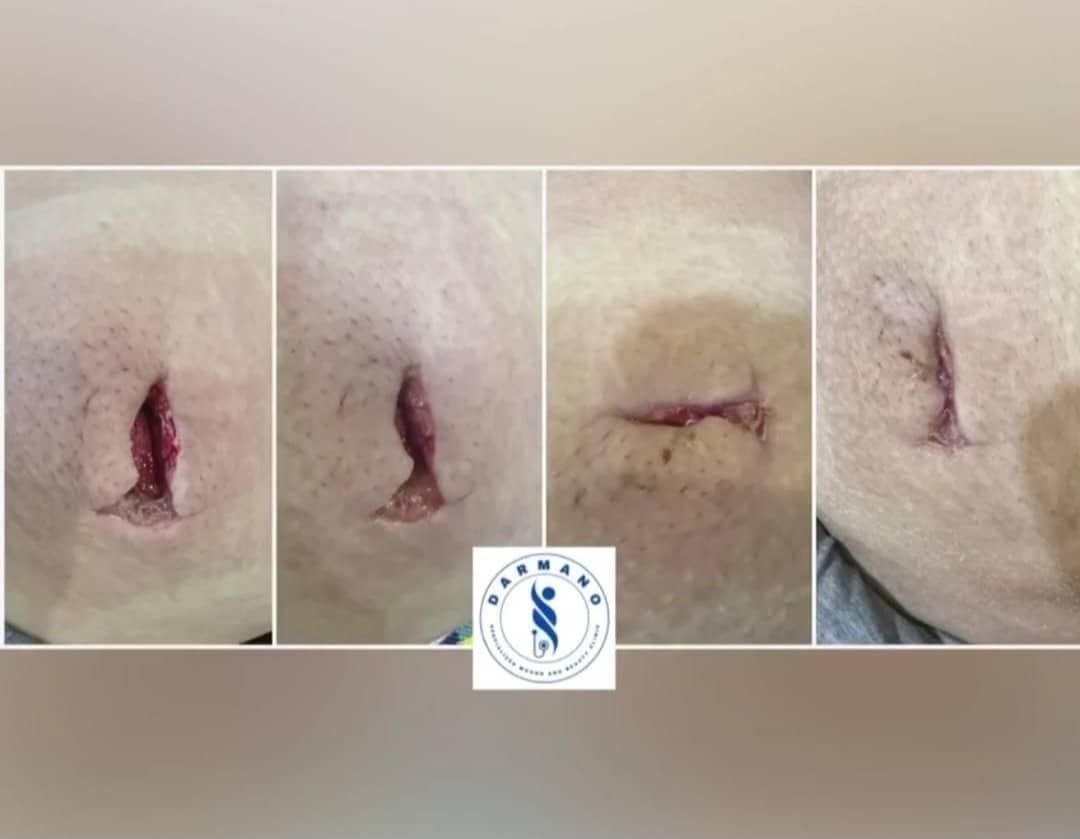 کلینیک تخصصی درمان زخم درمانو در اصفهان