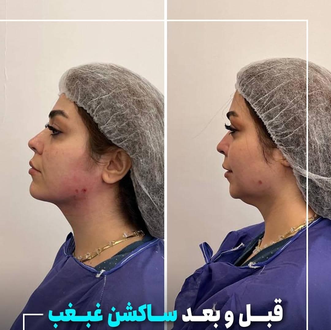 کلینیک زیبایی کامبیوتی در اصفهان