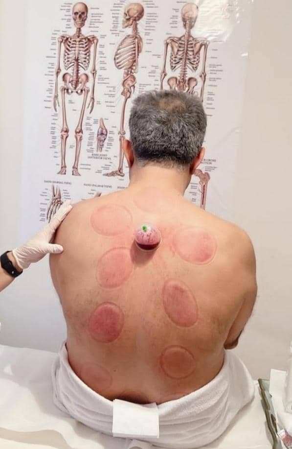 کلینیک زیبایی کامبیوتی در اصفهان