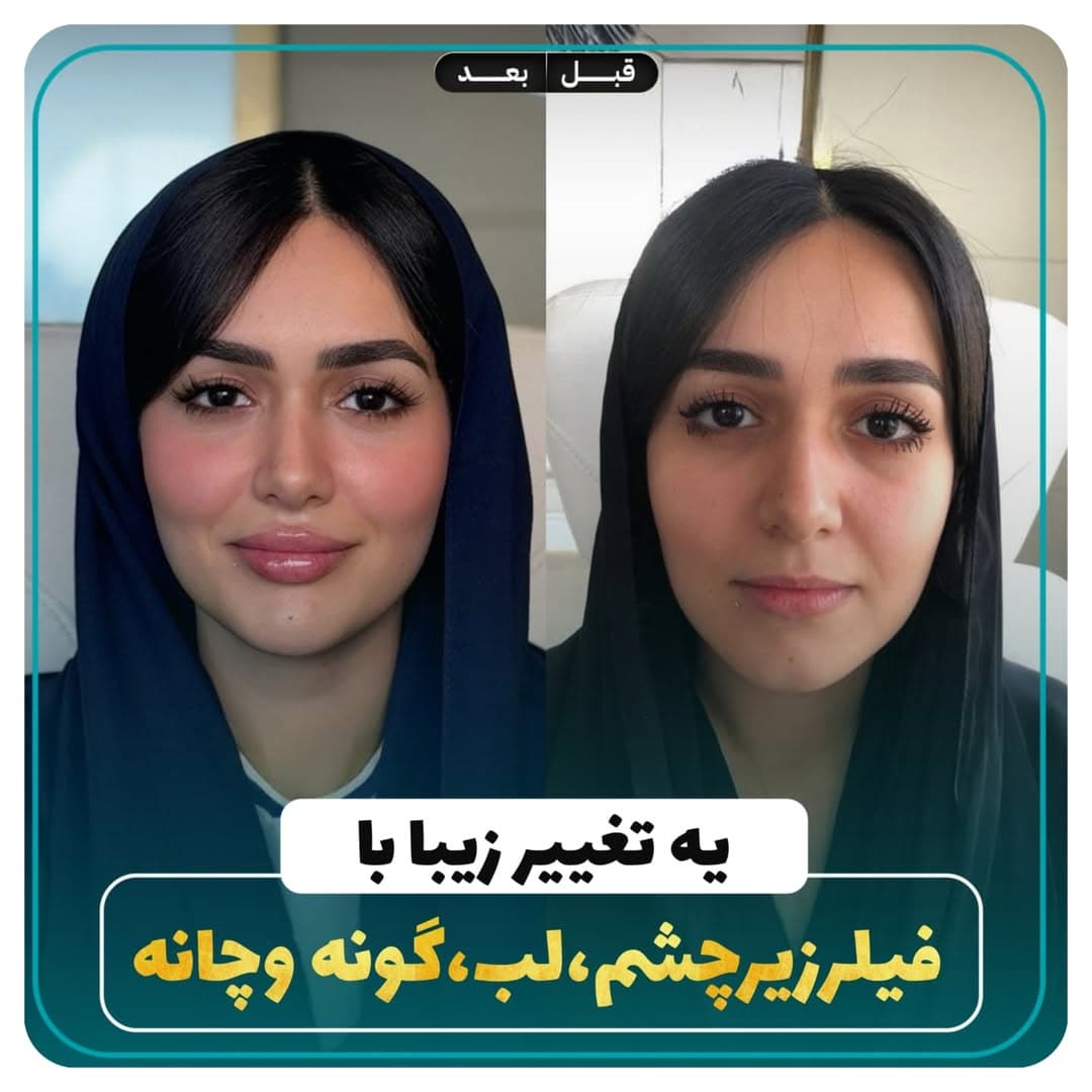 کلینیک زیبایی کامبیوتی در اصفهان