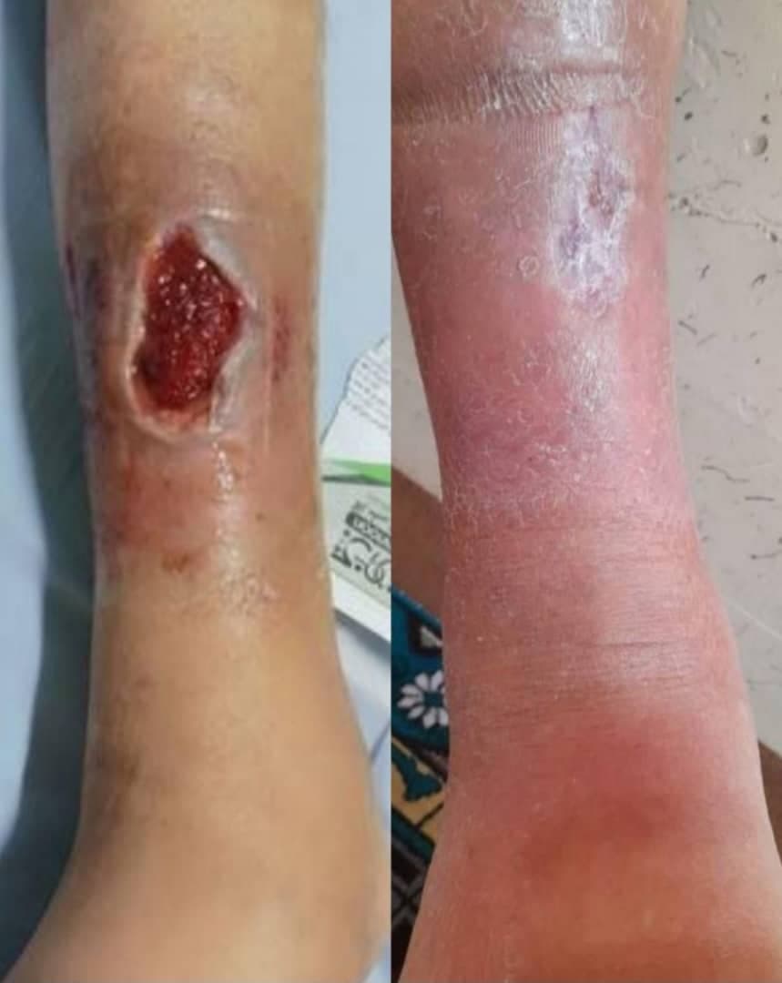 کلینیک تخصصی درمان زخم فردوس در اصفهان