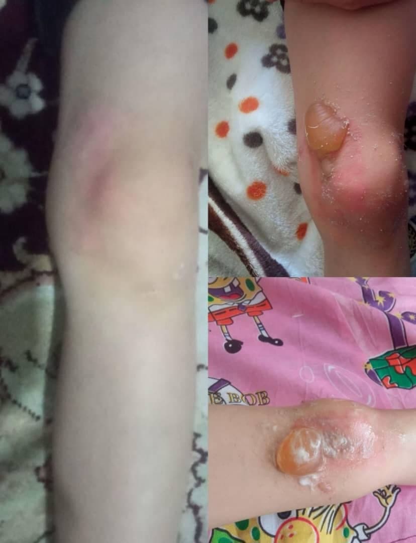 کلینیک تخصصی درمان زخم فردوس در اصفهان