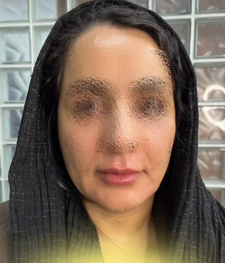 کلینیک زیبایی غزال در ونک تهران