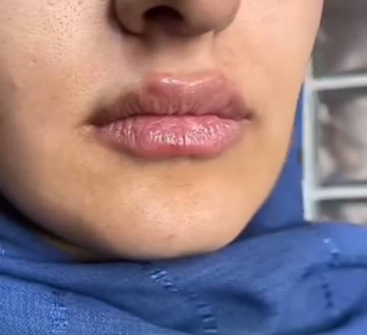 کلینیک زیبایی غزال در ونک تهران