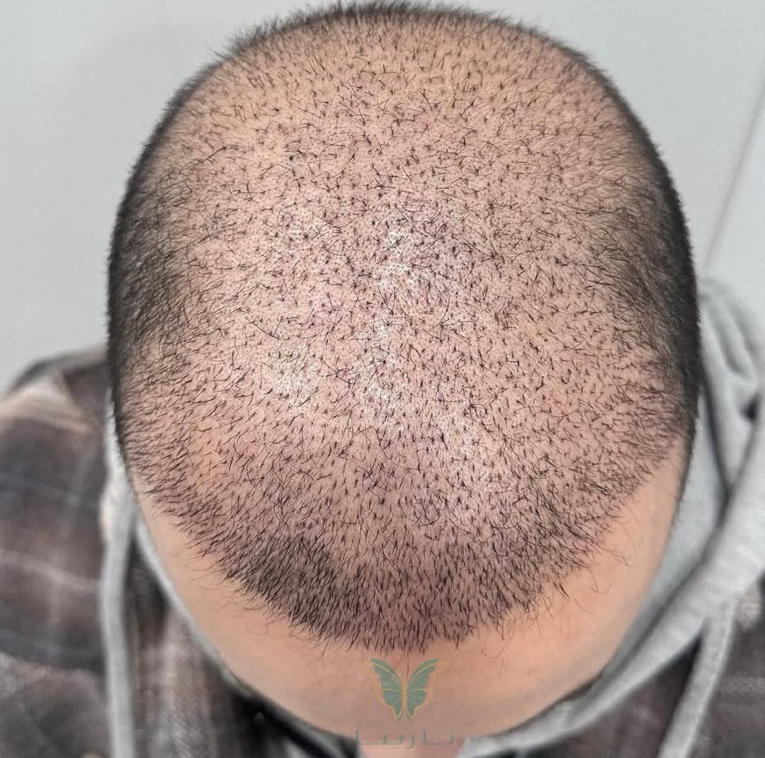 درمانگاه تخصصی پوست و مو نارینا در نازی آباد تهران