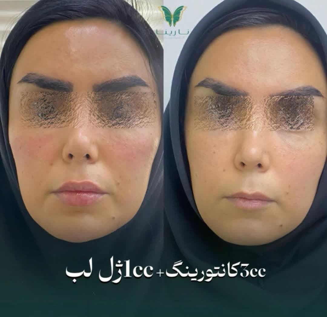 درمانگاه تخصصی پوست و مو نارینا در نازی آباد تهران