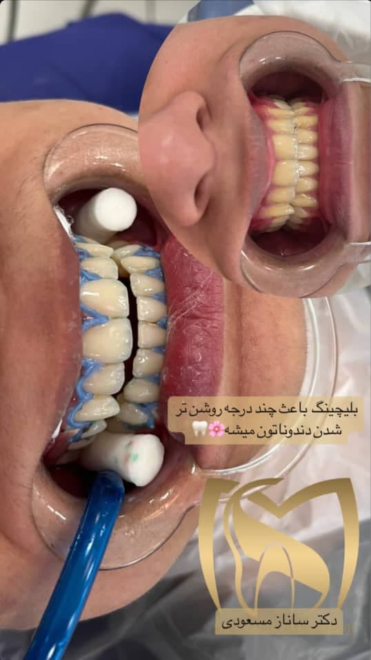 مطب دندانپزشکی دکتر مسعودی در تبریز