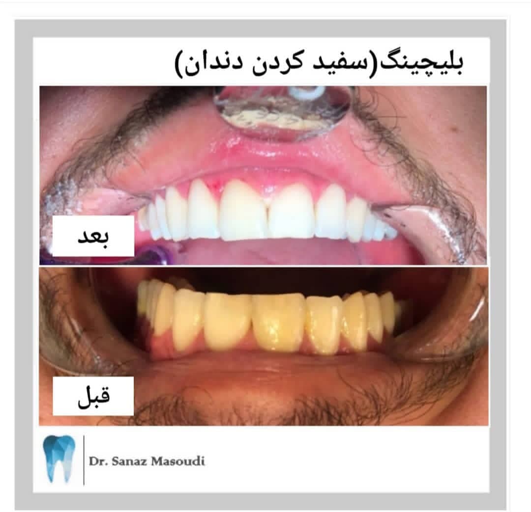 مطب دندانپزشکی دکتر مسعودی در تبریز