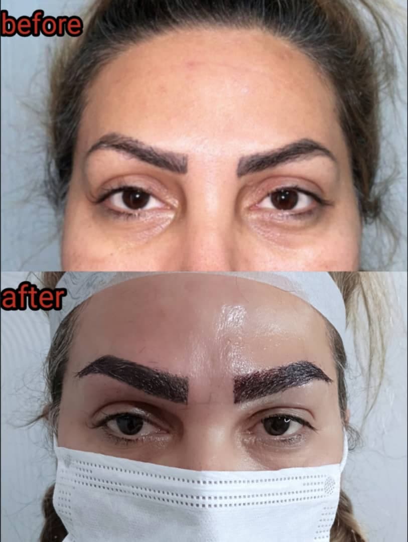 کلینیک تخصصی کاشت مو و ابرو رحمتی در ملارد