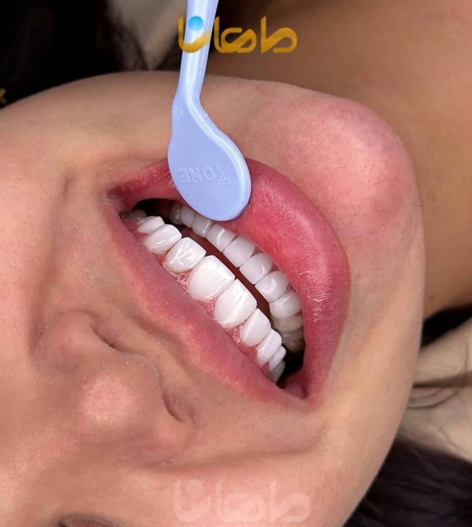 کلینیک تخصصی کامپوزیت و ایمپلنت دندان ماهانا در مطهری کرج