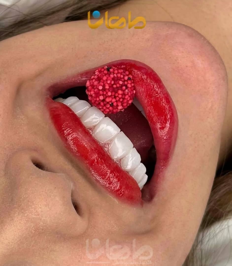 کلینیک تخصصی کامپوزیت و ایمپلنت دندان ماهانا در مطهری کرج