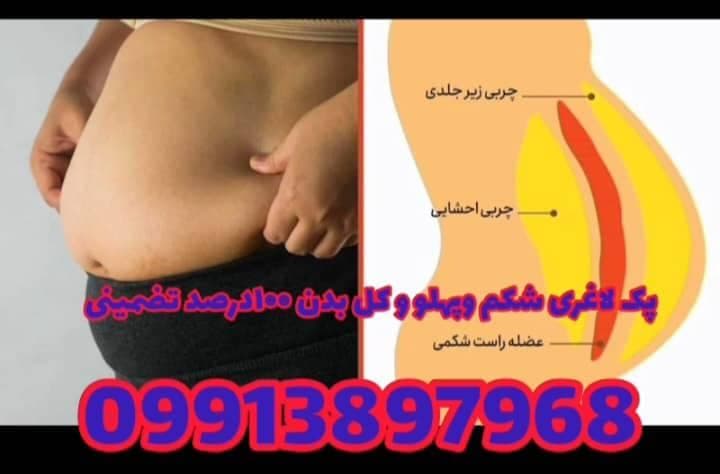 لاغری تضمینی شکم و پهلو با مکمل گیاهی بازمانده در کرمان