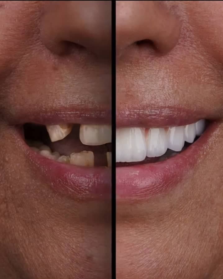 دندانپزشکی و خدمات کامپوزیت شبانه روزی صدف تهرانپارس تهران