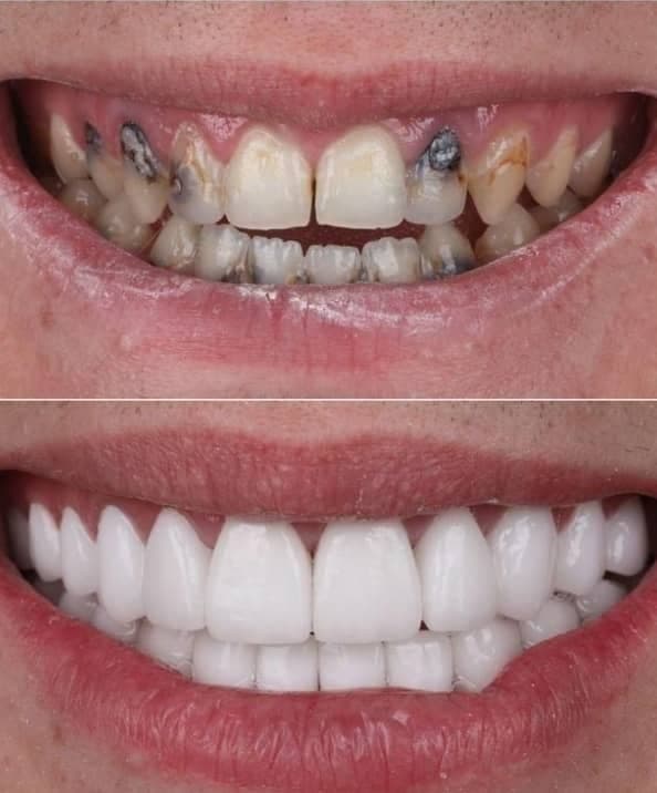 دندانپزشکی و خدمات کامپوزیت شبانه روزی صدف تهرانپارس تهران