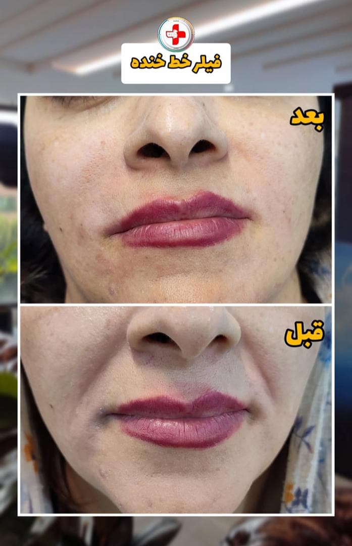کلینیک زیبایی سناتور در همدان