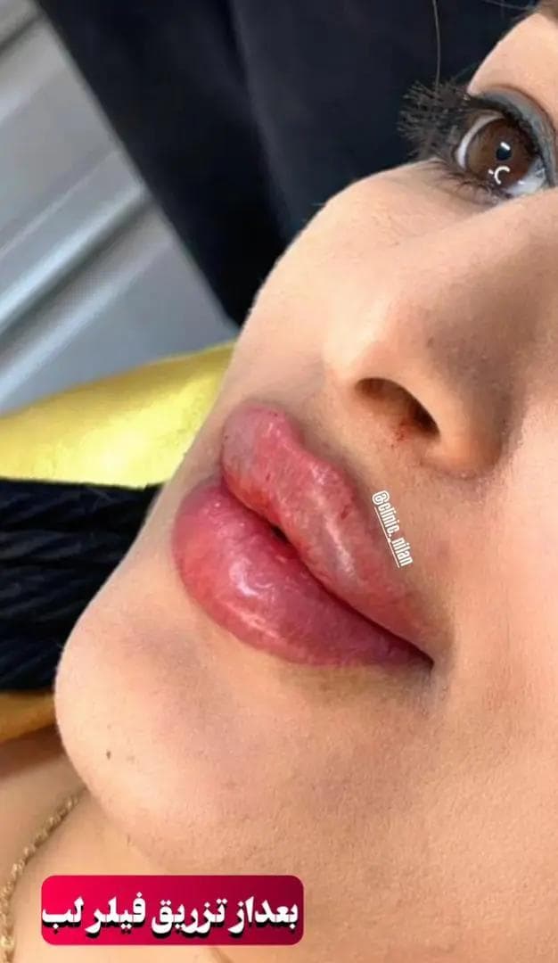 کلینیک تخصصی زیبایی نیلان در بهبهان
