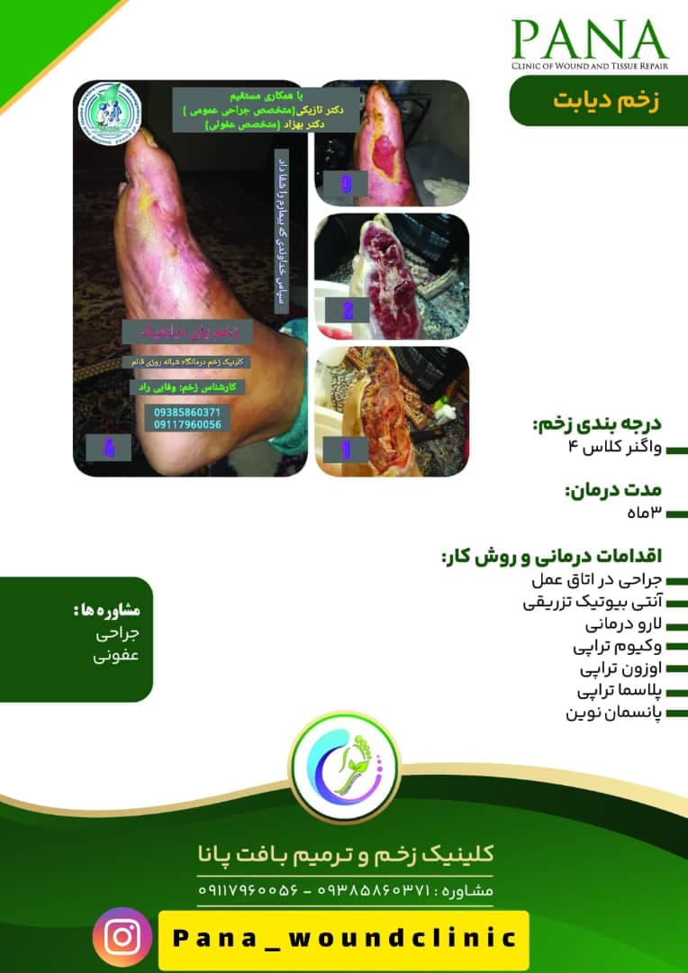 کلینیک زخم و ترمیم بافت پانا در گرگان