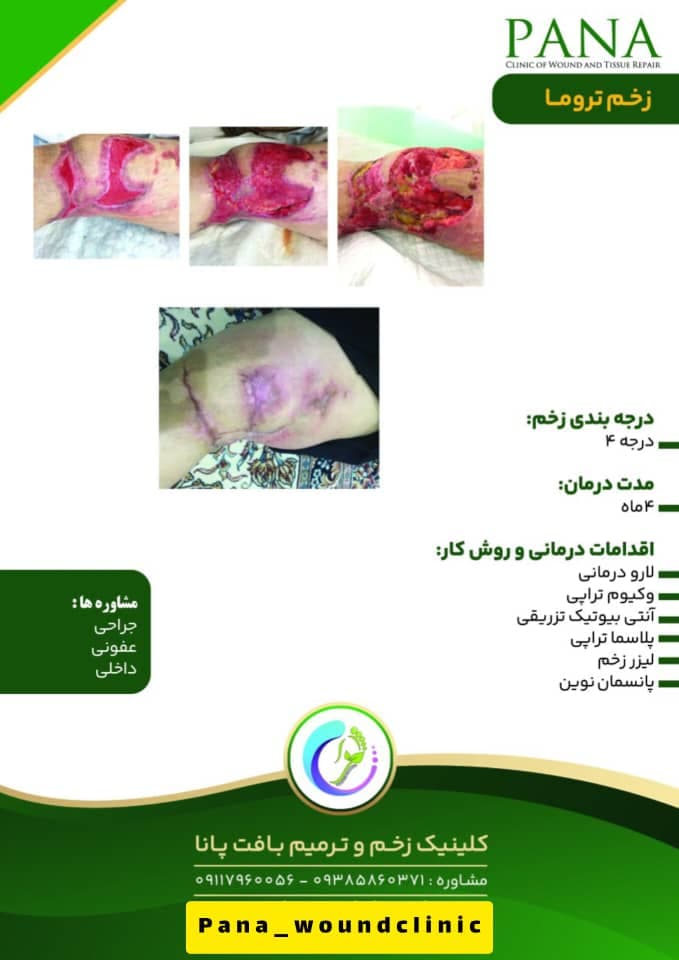 کلینیک زخم و ترمیم بافت پانا در گرگان