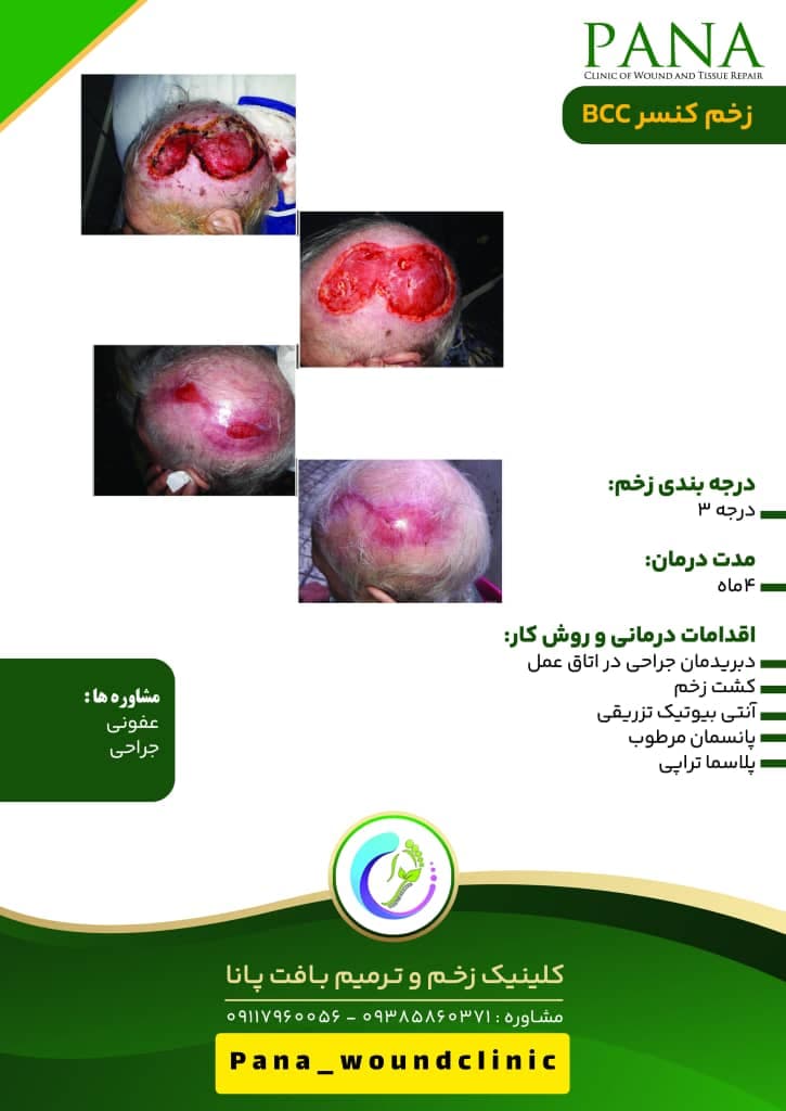 کلینیک زخم و ترمیم بافت پانا در گرگان