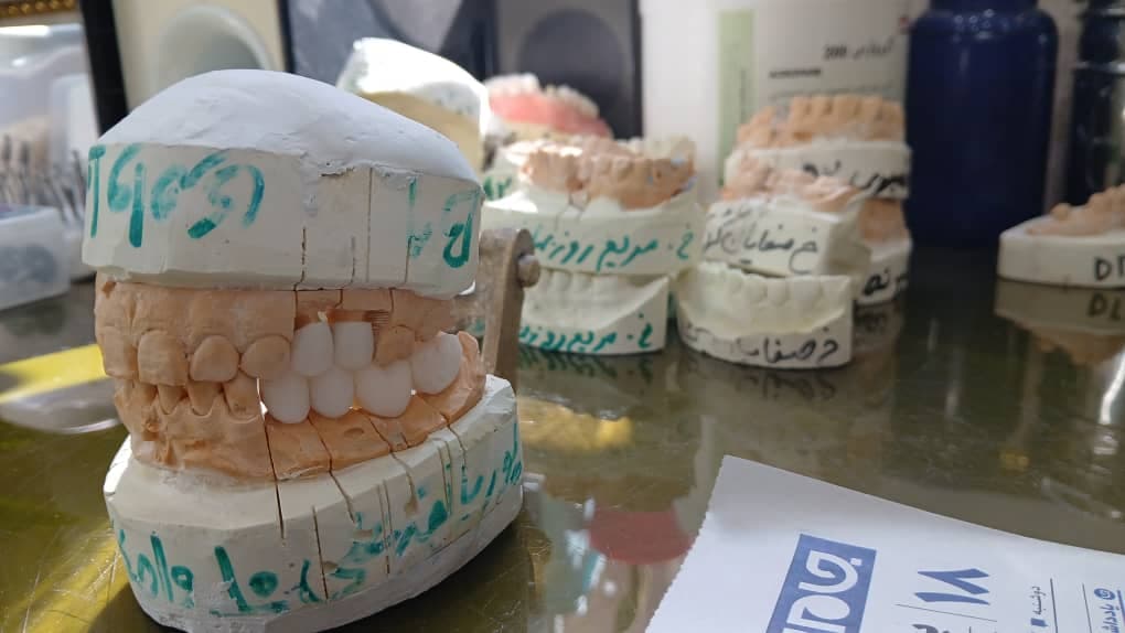 تکنسین پروتزهای دندانی عباس بهنام پور در ملایر