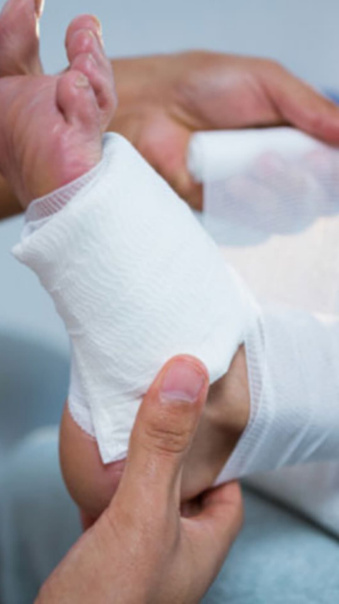 درمان زخم دیابتی و بستر درمانگر زخم طاها اکبری در تبریز