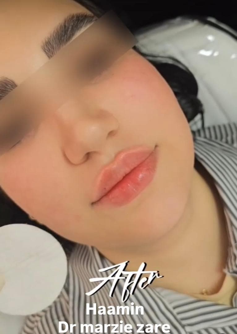 کلینیک زیبایی پوست و مو و لیزر هامین در شیراز