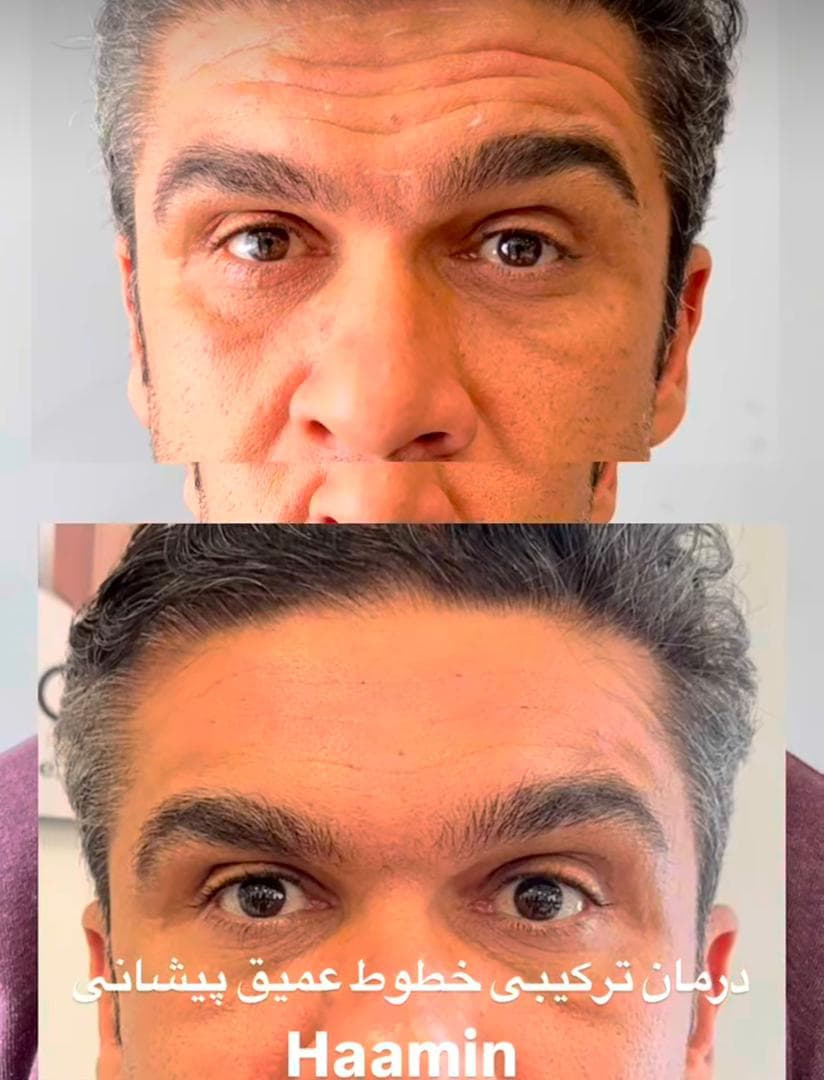 کلینیک زیبایی پوست و مو و لیزر هامین در شیراز