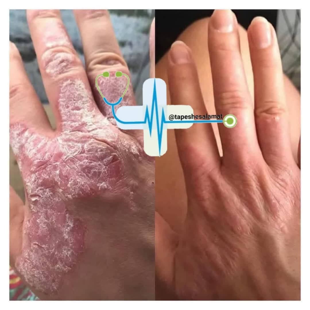 مرکز تخصصی لاغری با جلبک اسپیرولینا دکتر فخار در قم