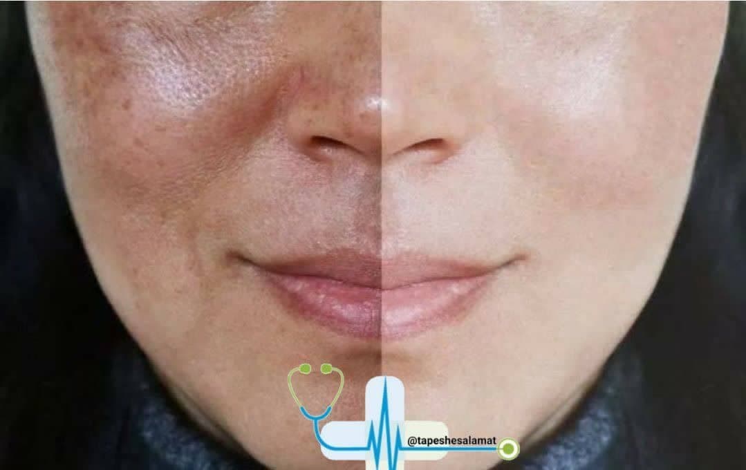 مرکز تخصصی لاغری با جلبک اسپیرولینا دکتر فخار در قم