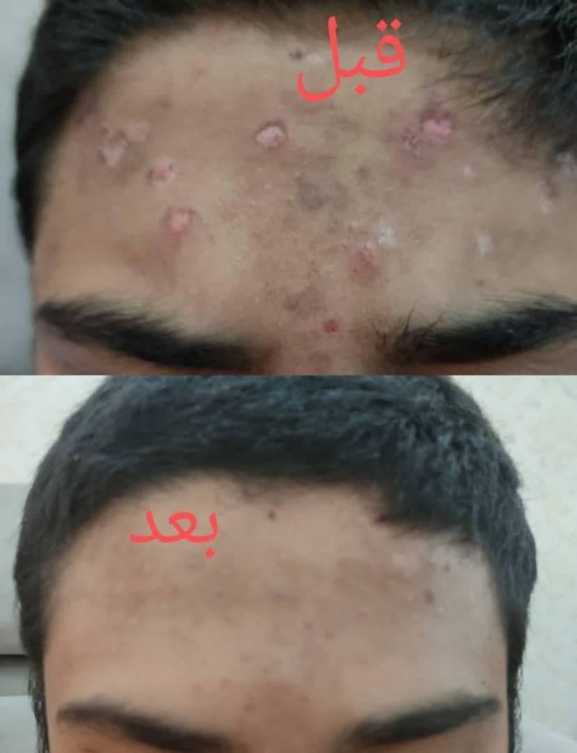 مرکز تخصصی لاغری با جلبک اسپیرولینا دکتر فخار در قم