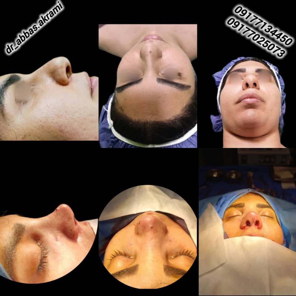 فوق تخصص جراحی پلاستیک زیبایی و ترمیمی دکتر عباس اکرمی در شیراز