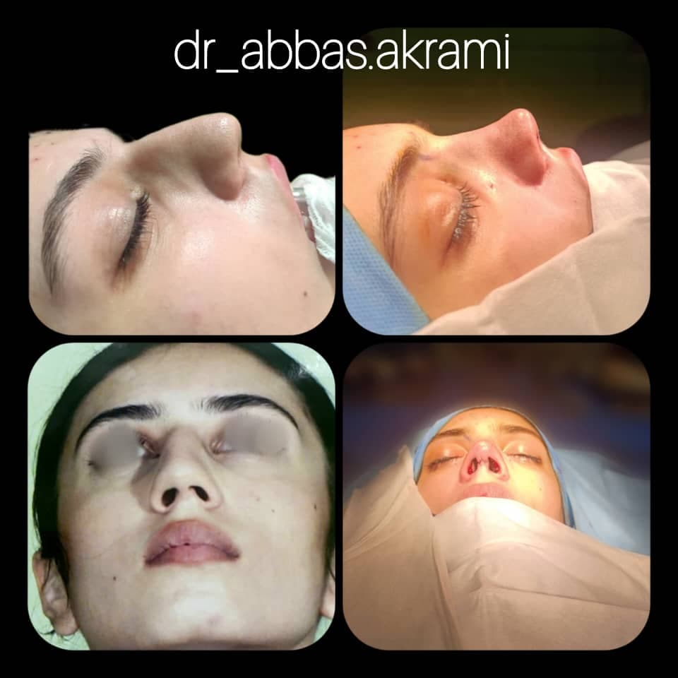 فوق تخصص جراحی پلاستیک زیبایی و ترمیمی دکتر عباس اکرمی در شیراز