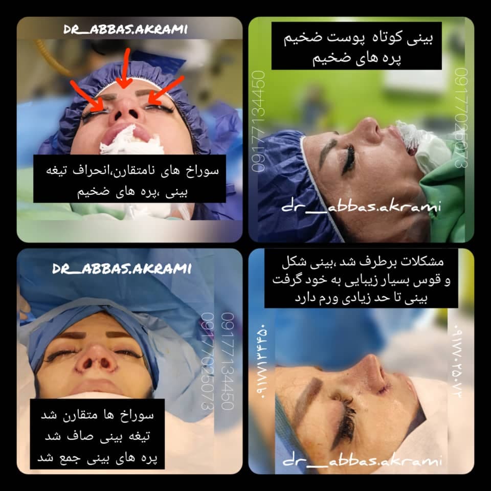 فوق تخصص جراحی پلاستیک زیبایی و ترمیمی دکتر عباس اکرمی در شیراز