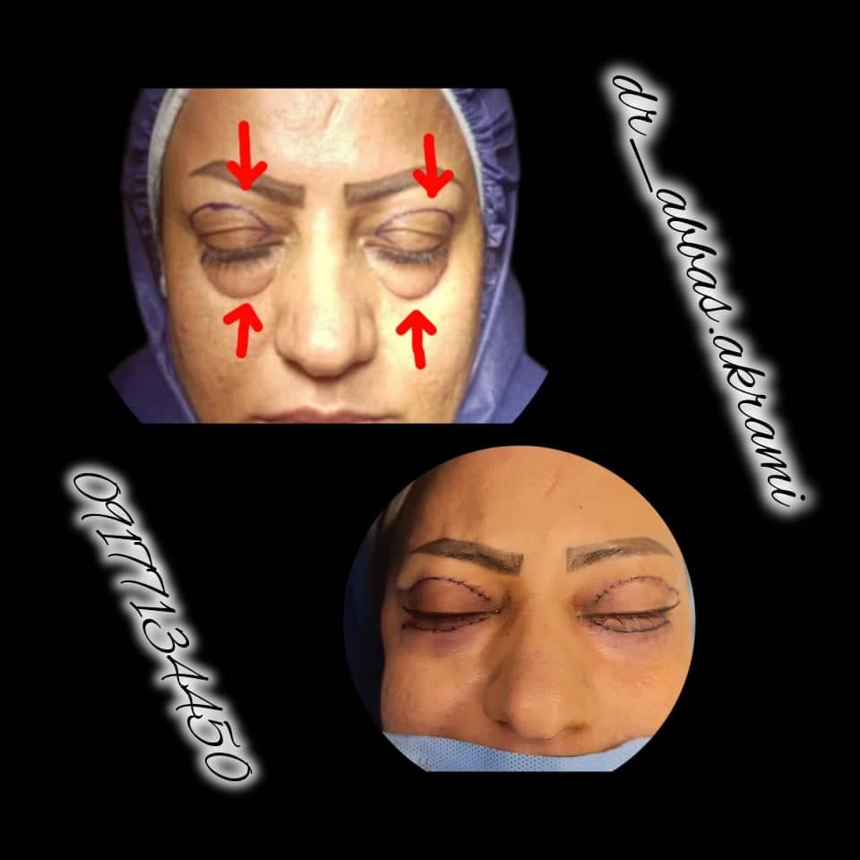 فوق تخصص جراحی پلاستیک زیبایی و ترمیمی دکتر عباس اکرمی در شیراز