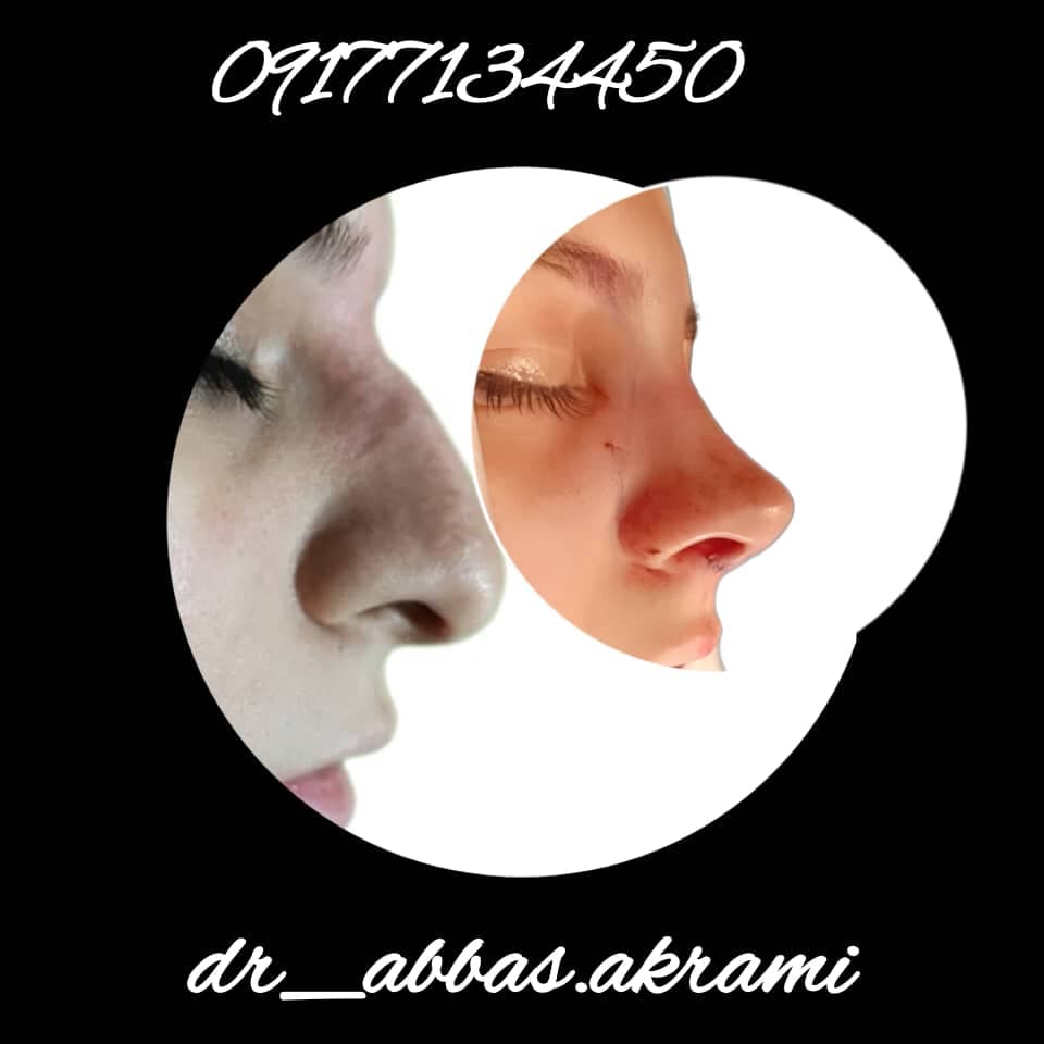 فوق تخصص جراحی پلاستیک زیبایی و ترمیمی دکتر عباس اکرمی در شیراز