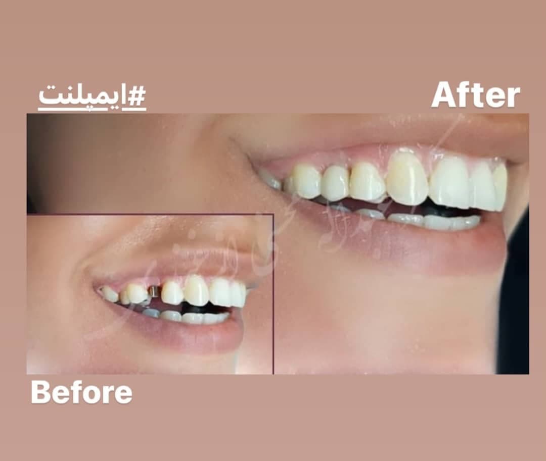 کلینیک دندانپزشکی پارس در مطهری تربت حیدریه