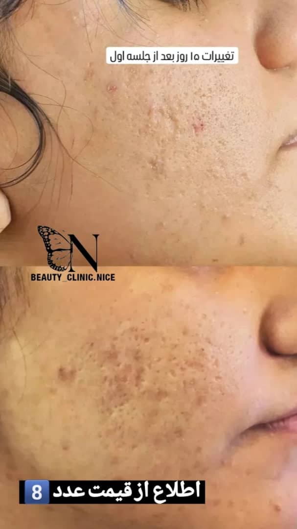 مرکز زیبایی و تزریق ژل و بوتاکس صبا میر در خرم آباد